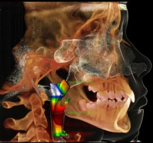 CBCT PRO READ SERVICE